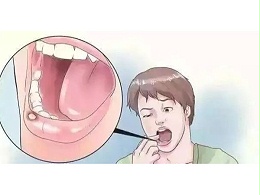 口腔溃疡反反复复，补充维C就能好？